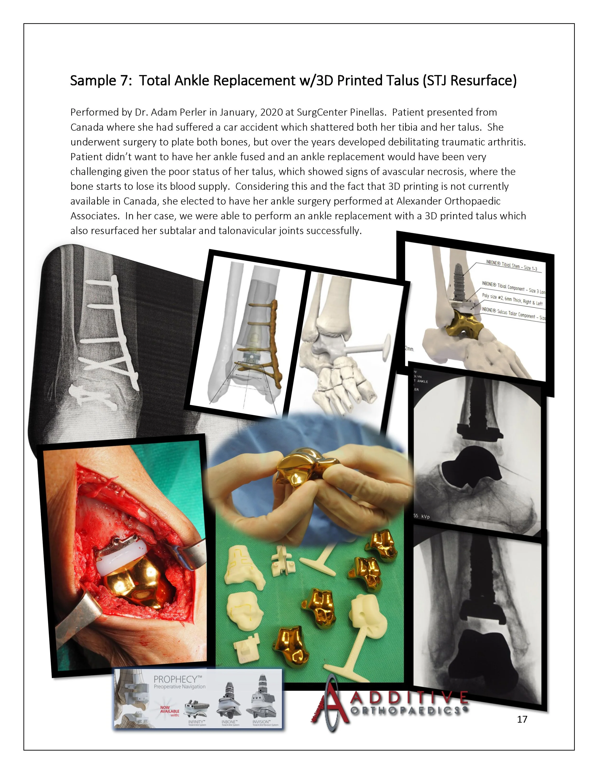 3D-Printing-AOA-Patient-Guide_Page_17.jpg