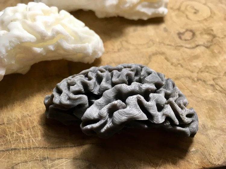 Alzheimer's brain model: Part 2