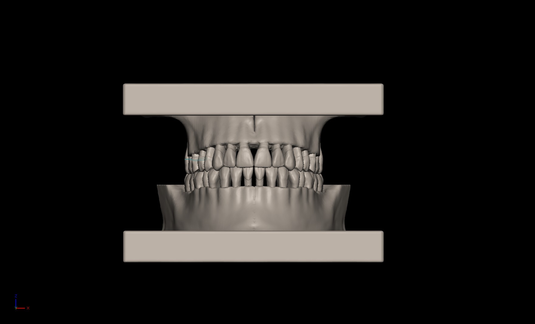 Teeth Pic1.jpg