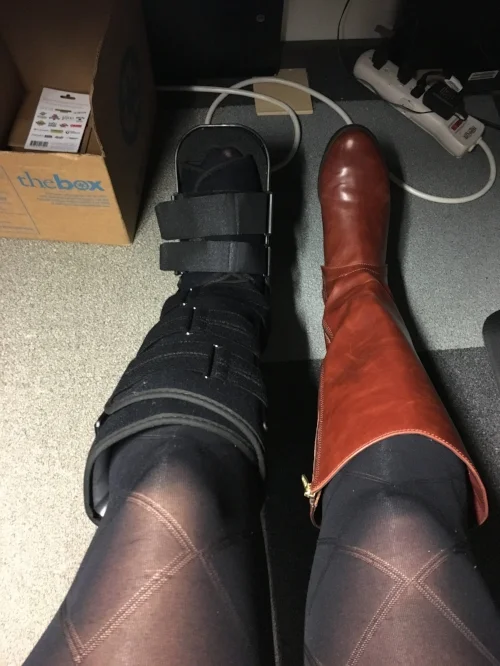 The view under my desk. I also had to give up my standing desk for 2 months, which was torture. Sitting all day hurts!