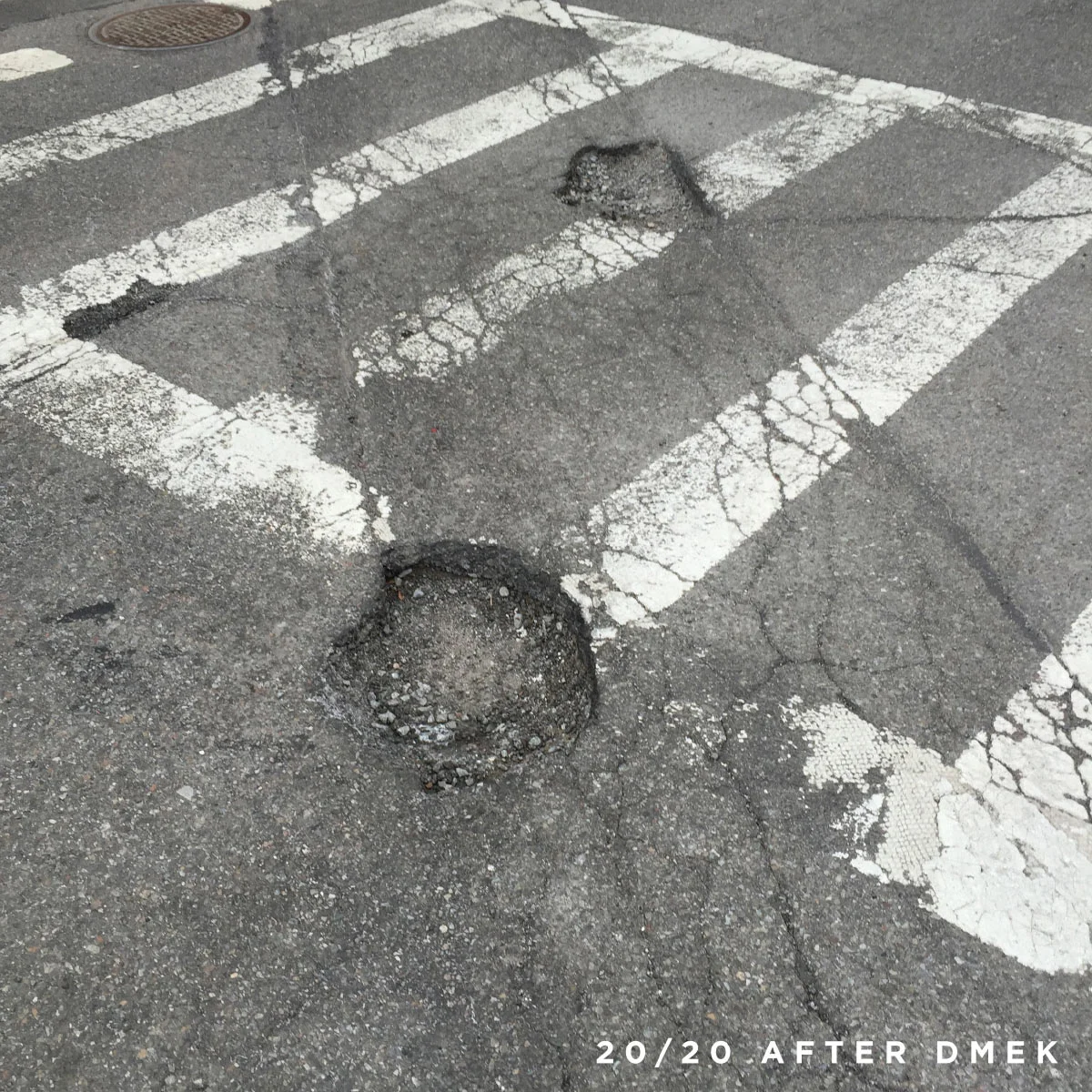 DMEK_potholes_1_L1.jpg