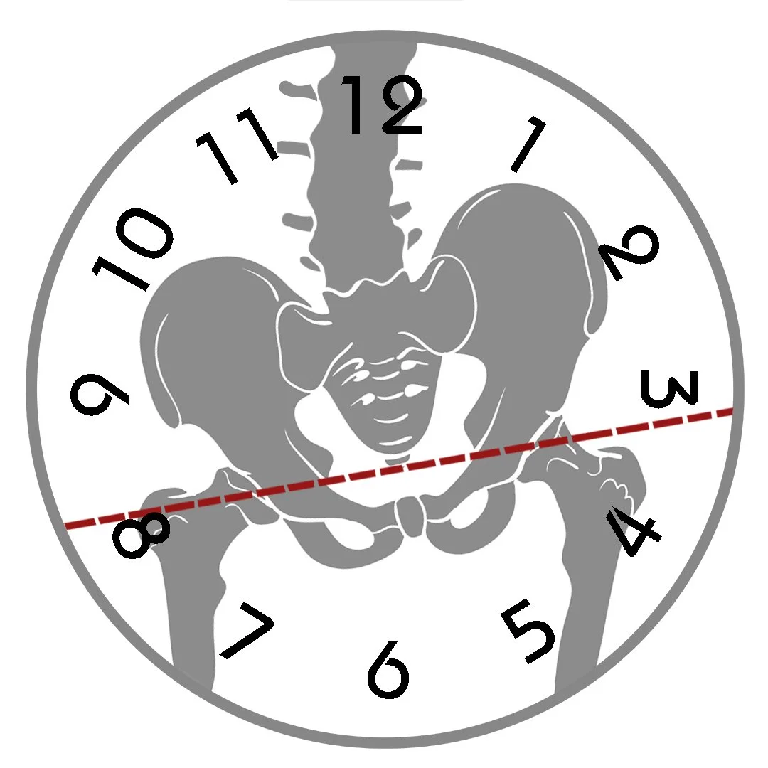 Lateral Pelvic Tilt Uneven Hips.jpg