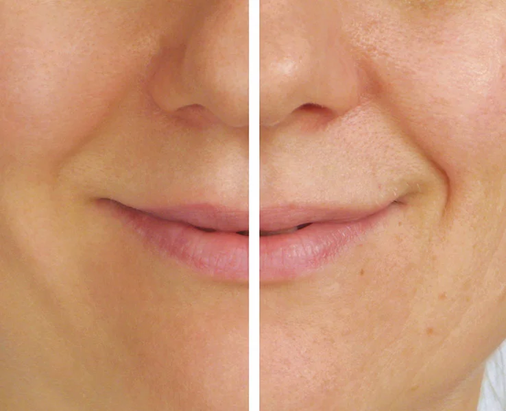 juvederm.jpg