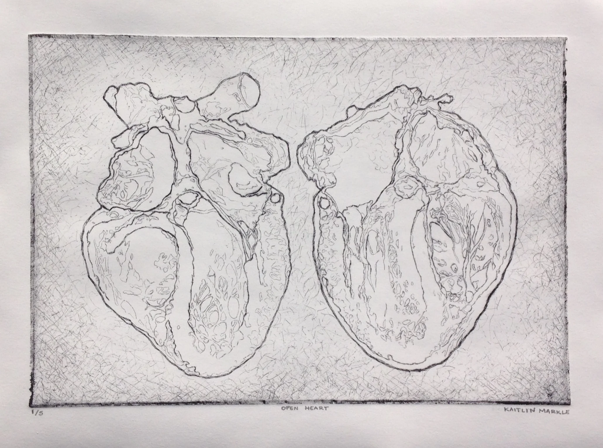 "Open Heart" by Kaitlin Markle