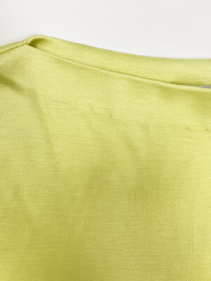 Stephen Sprouse 80s neon yellow babydoll dress — JAMES VELORIA