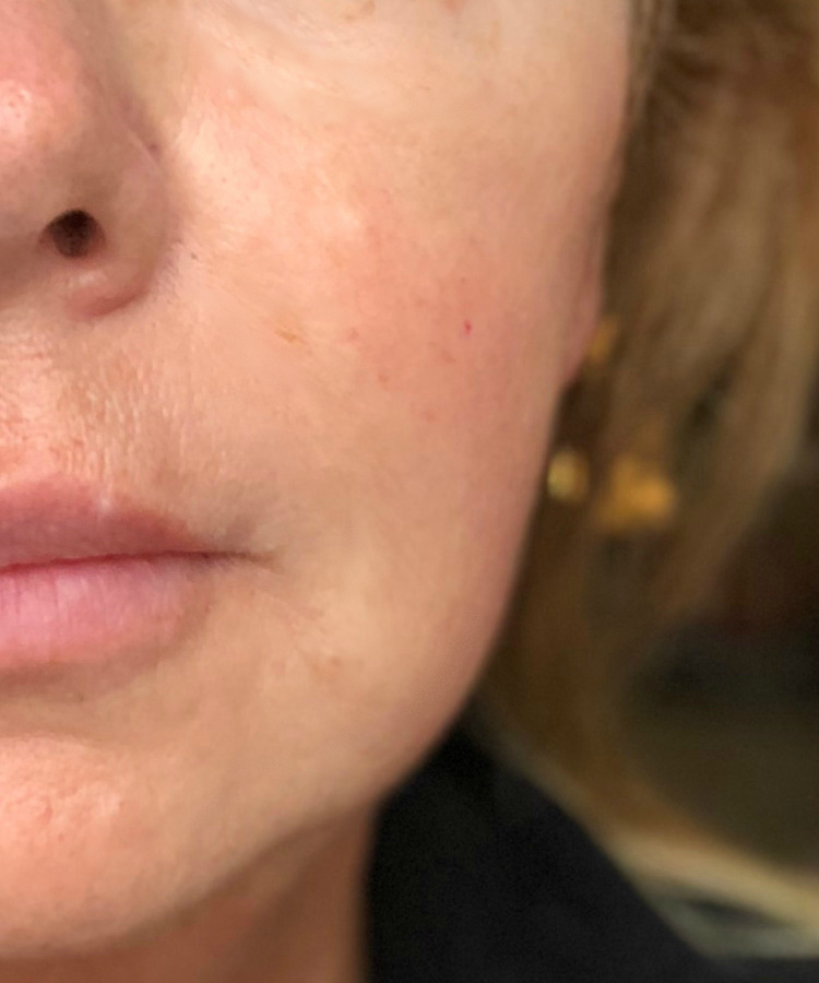 strivectin wrinkle recode cream