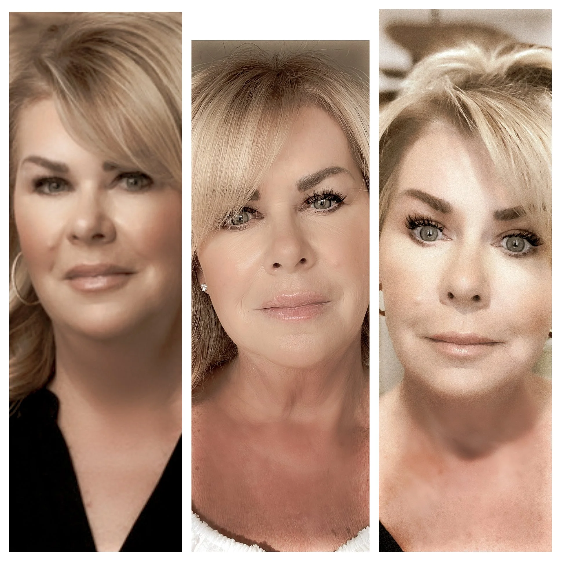 Discover the Benefits of Semaglutide: My Journey with the Revolutionary