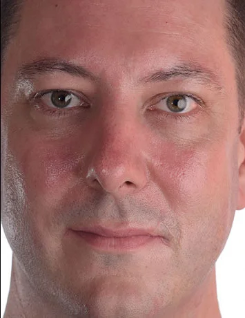 Stop the shine. Excessive use of face moisturiser is to be avoided for headshot photography.