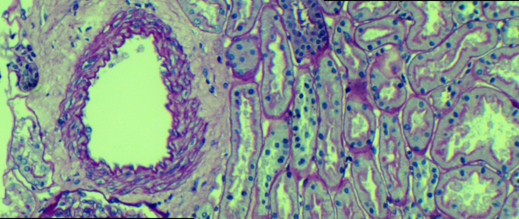 Human Kidney (PAS)
