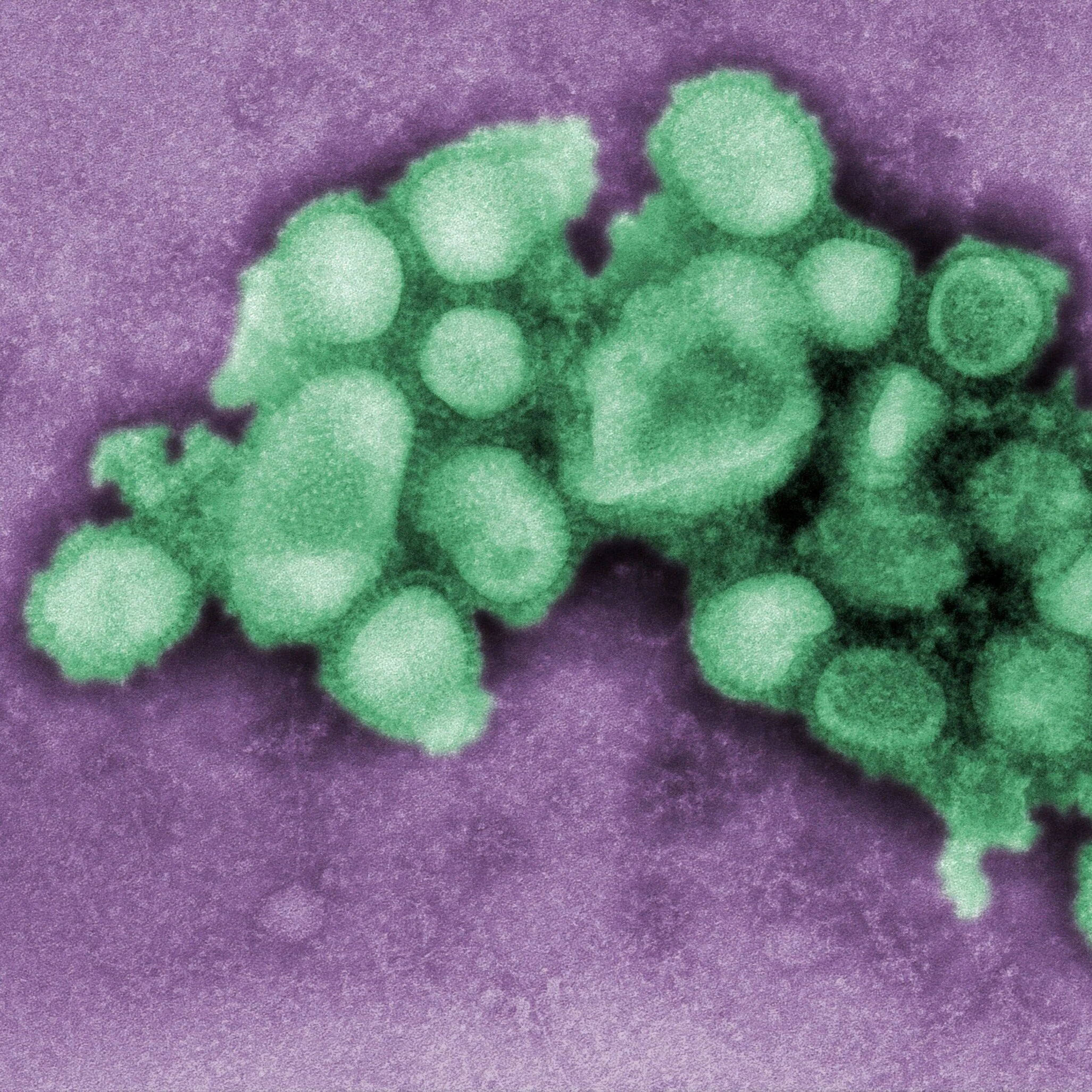USDA Confirms African swine fever in the Dominican Republic