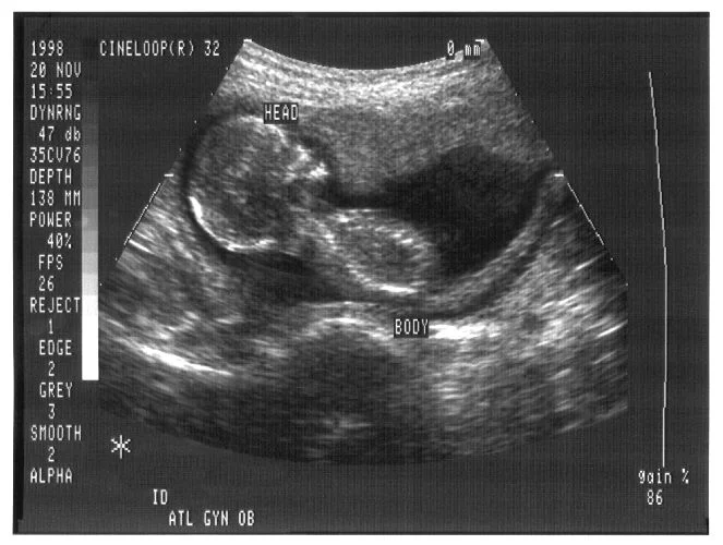 Image from http://www.publicdomainfiles.com/show_file.php?id=13526946615346