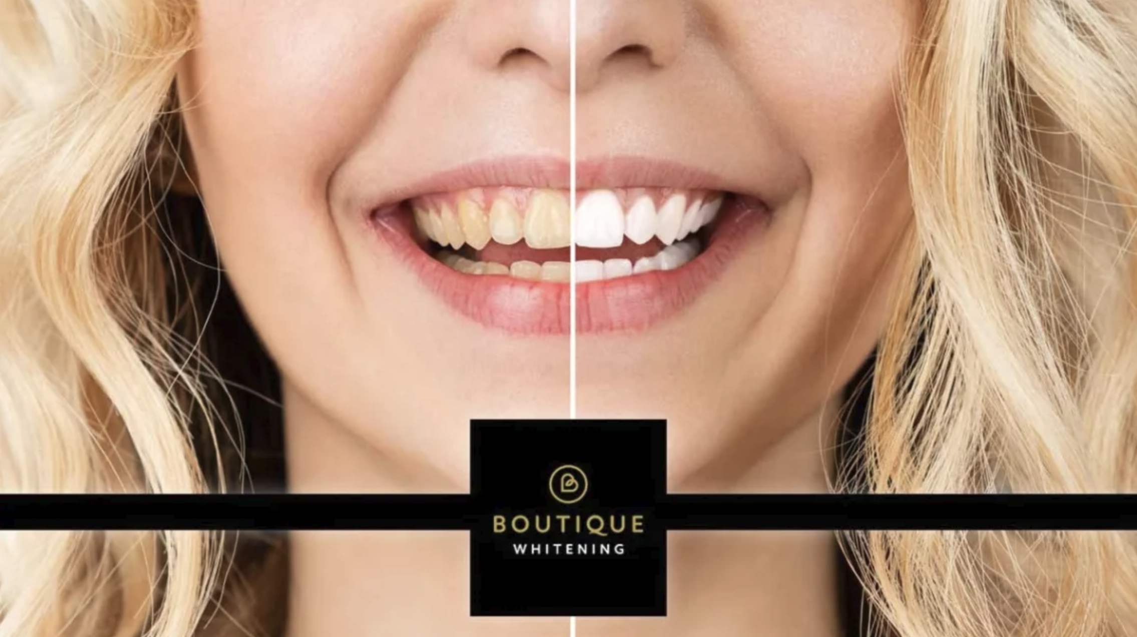 TalkingHeadsBeautyTeethTranslation-Boutique-03.png