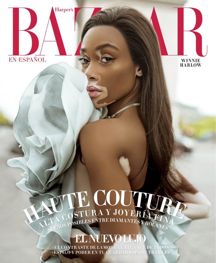 Winnie Harlow by Jacques Burga for Harper's Bazaar Mexico and Latin America Nov 2018 (1).jpeg