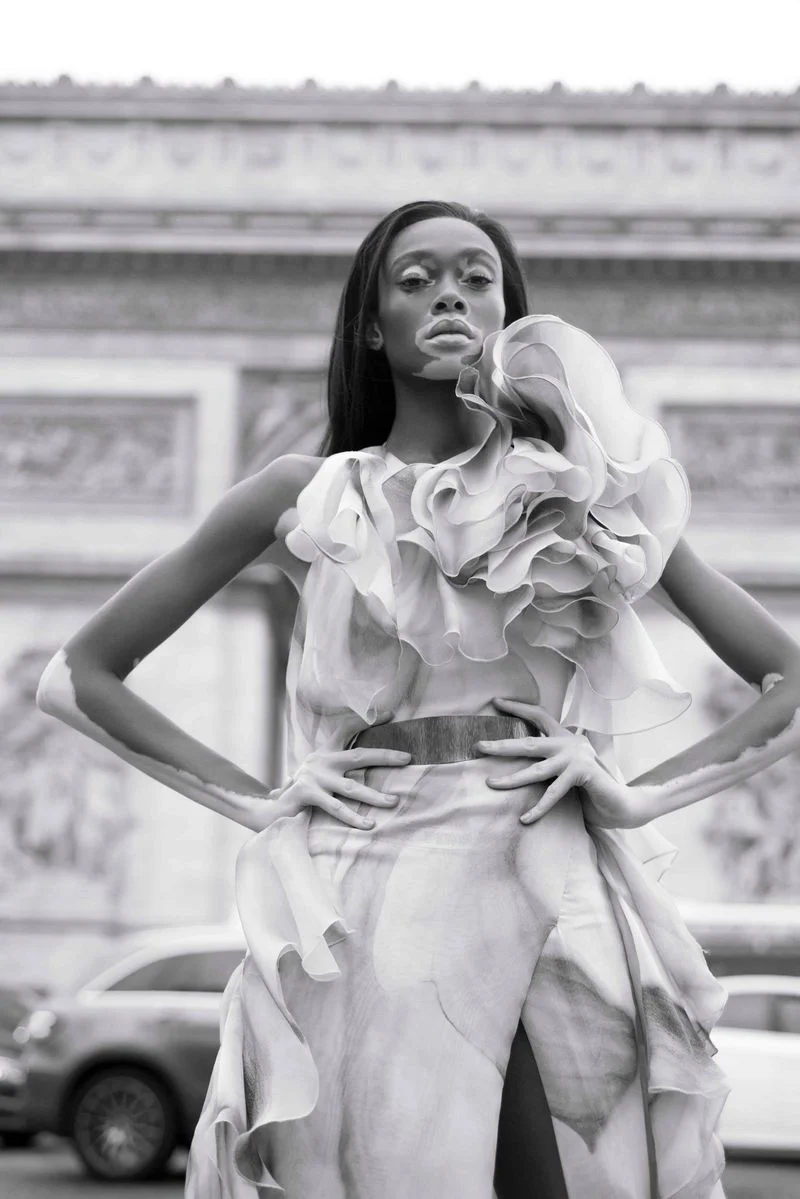 Winnie Harlow by Jacques Burga for Harper's Bazaar Mexico and Latin America Nov 2018 (1).jpg