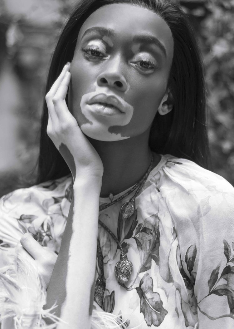 Winnie Harlow by Jacques Burga for Harper's Bazaar Mexico and Latin America Nov 2018 (2).jpeg