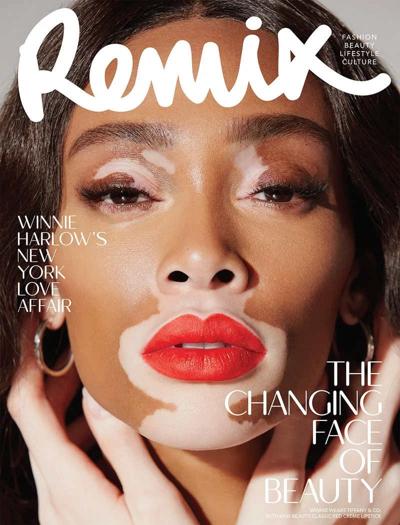 Winnie-Harlow-Dennis-Leupold-Remix-Mag-April-2019- (1).jpg