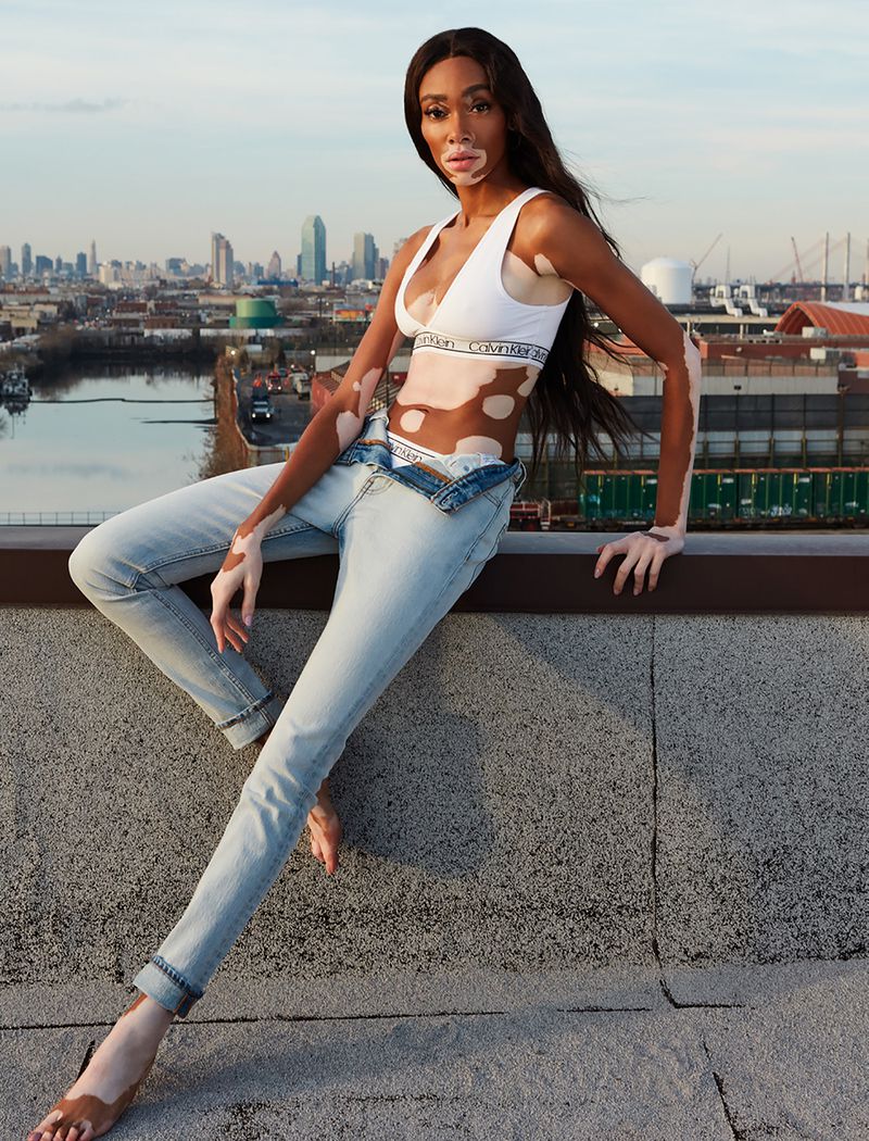 Winnie-Harlow-Dennis-Leupold-Remix-Mag-April-2019- (10).jpg