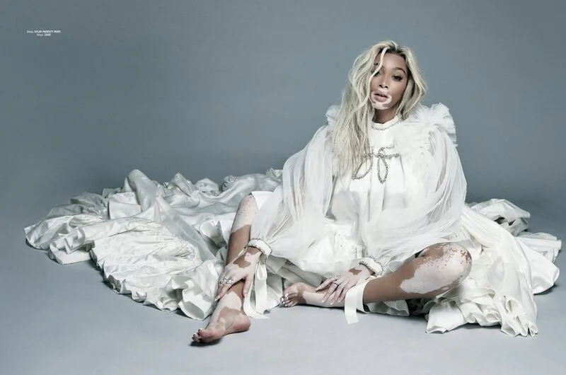 Winnie Harlow by Bryce Thompson L'Officiel Cyprus Sp 2021 (1).jpg