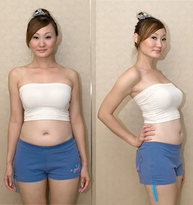Me at week 5, before knowing I have triplets.