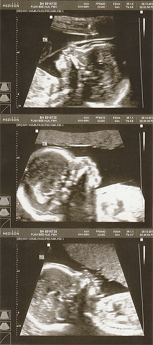 Babies’ side profiles.