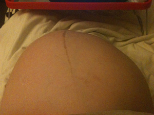As the babies grow, my tummy sometimes form odd shape and lately I woke up with 2 humps like a camel.