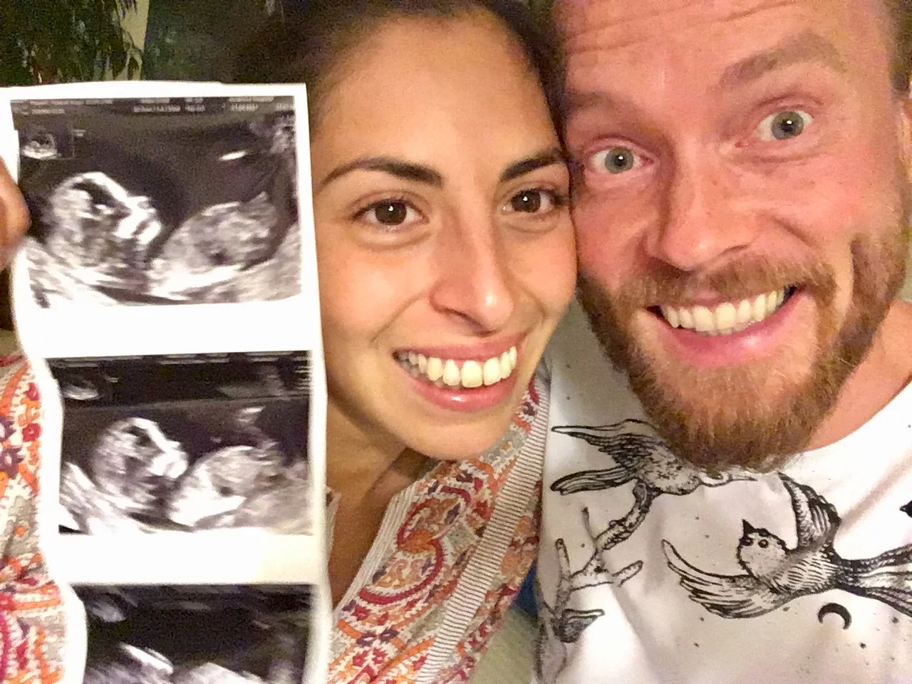 Our first scan! It was wonderful to be able to see the little one. La nostra prima ecografia! E' stato fantastico poter vedere il/la piccolo/a.