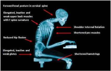 computer posture.jpg