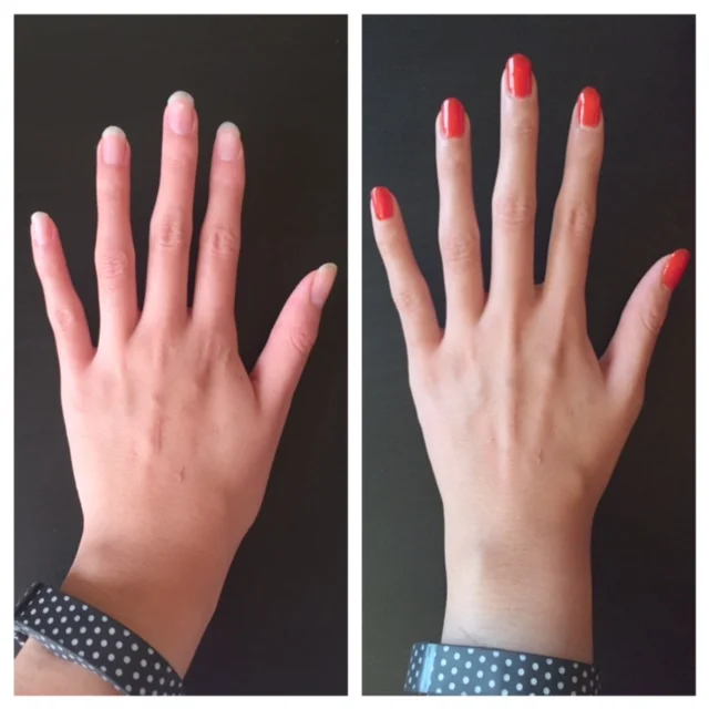Before & After