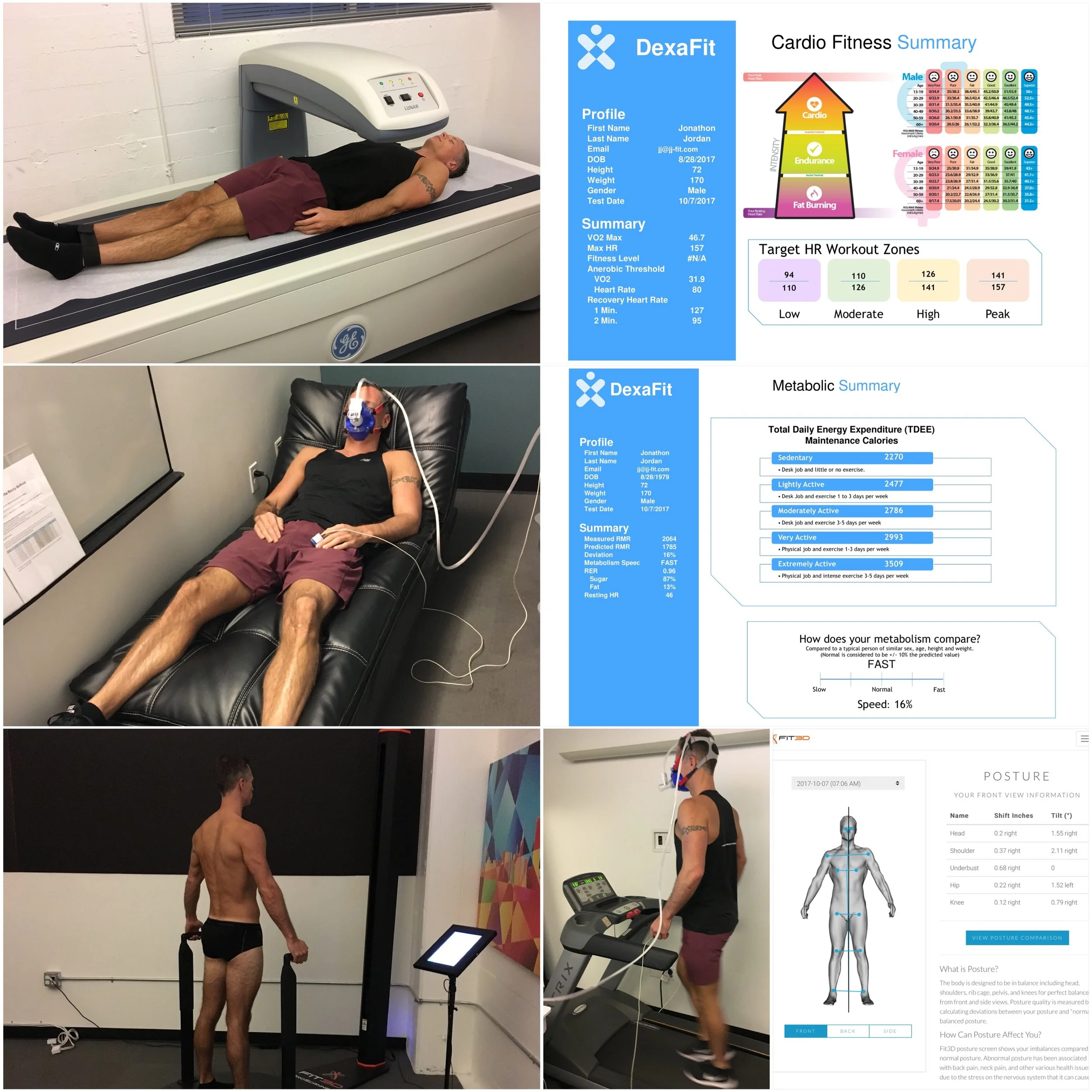 What We Can Learn from Metabolic Testing