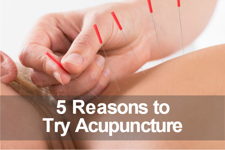 5-reasons-to-try-acupuncture-image.jpg
