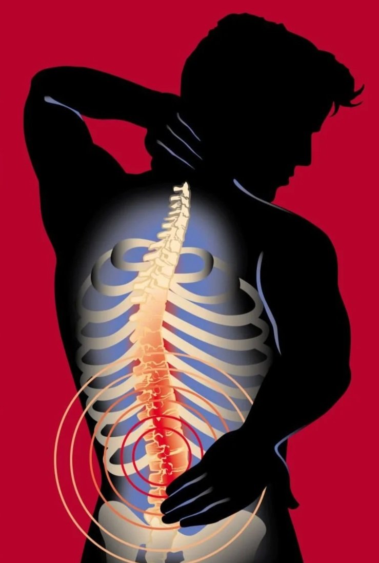 Acuncture for Back Pain