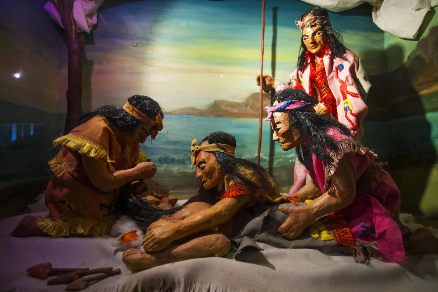 Inca Trephination Inca Trepanation