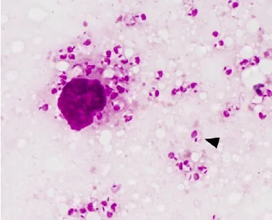 Leishmania amastigotes living in a mammal. The big purple blob is a white blood cell. These amastigotes live inside the white blood cells as they cause disease.