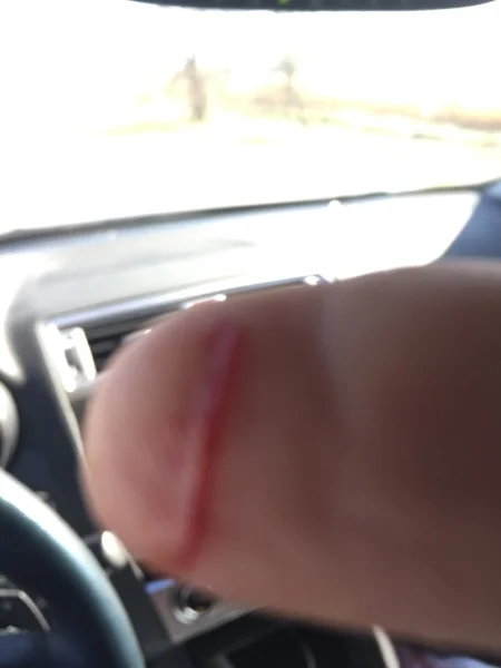 Minor injury sustained from making a sandwich while driving.