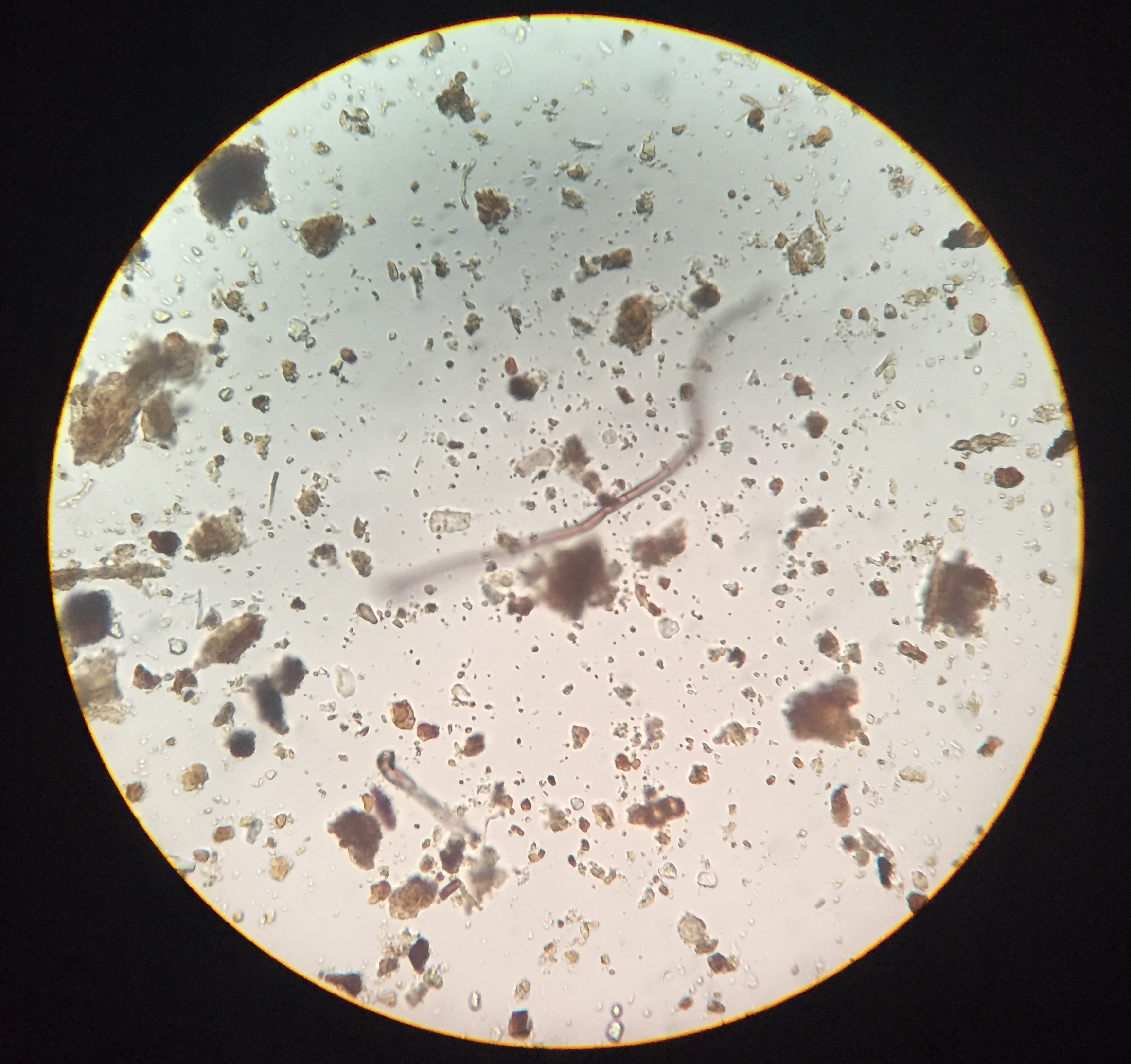 Microscope image of beneficial fungal hyphae, by Becca Verm. 400x total magnification.