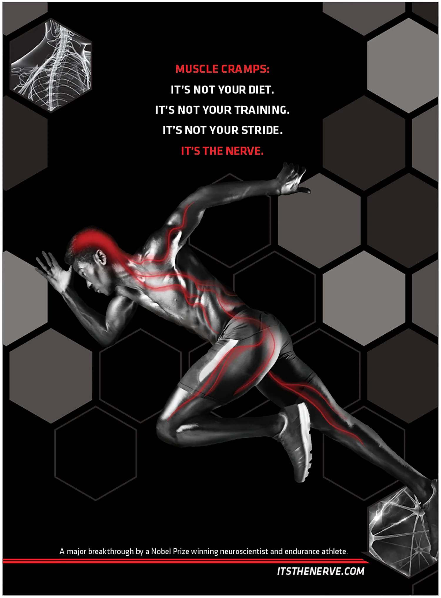 It's the nerve 3.jpg