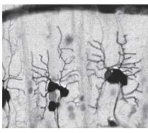 RNAi screen.png