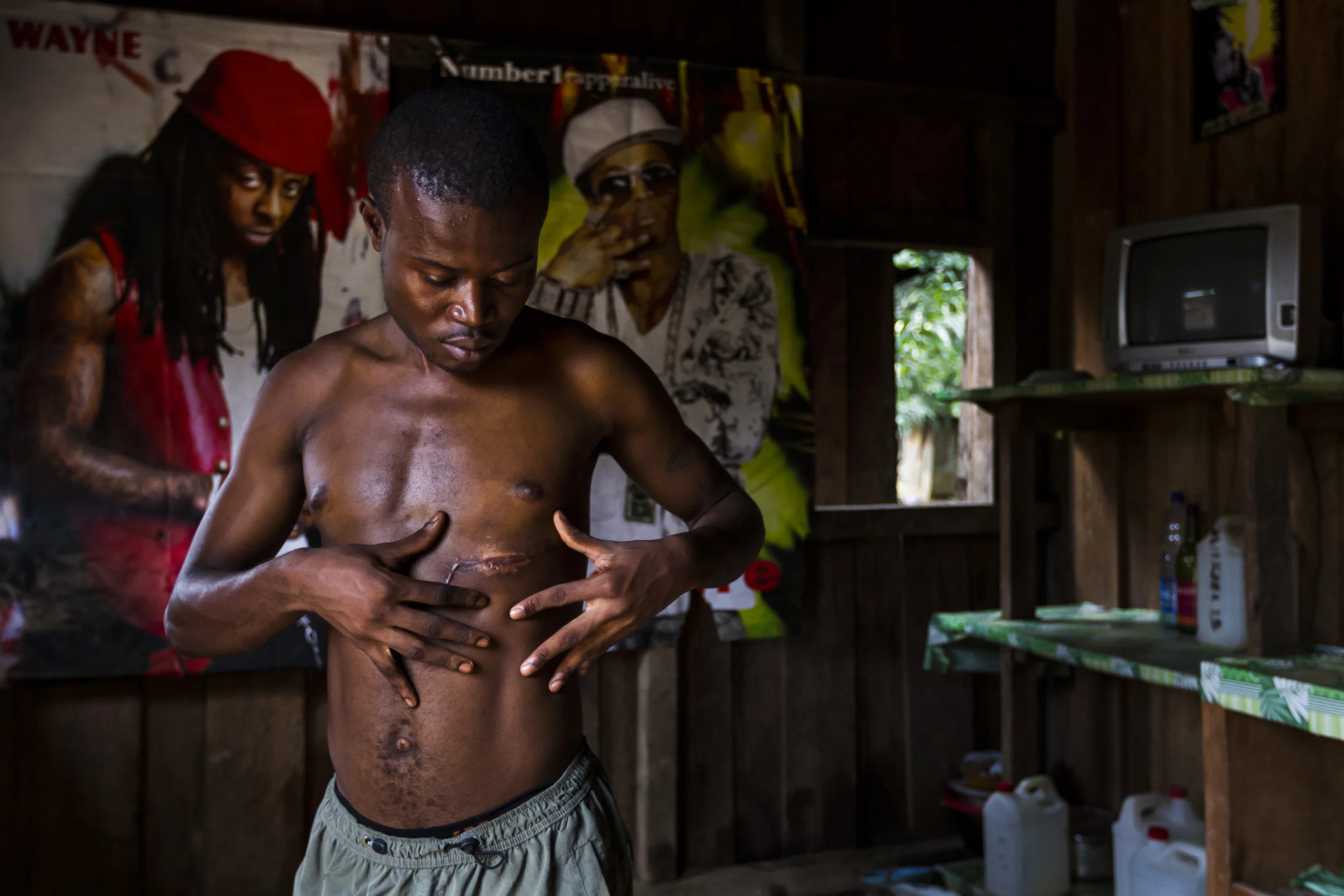 IVINDO, GABON, JULY 2011: A suspected elephant poacher wounded by an enraged elephant examines his healing injury under the gaze of hip-hop posters which adorn his home in Ivindo, Gabon, July 3, 2011. This man claims he shot at the elephant in self-defence but this is the second time he and two accomplices have been implicated in a self-defence incident involving elephant this year. They claimed to have been hunting bush-pig but the calibre of weapon they were using as well as the fact that they have been involved in two elephant incidents recently has led Gabon Parcs authorities to suspect their true motives to be elephant poaching for ivory. The fact that the ivory of one of the elephants they claim to have killed in self-defence is missing further compounds their guilt in the eyes of the authorities. The man pictured, Hubert Mebouaya, 26, claims they were hunting for bush-pig when he and his two friends were set upon by an elephant, he tried to run but was trapped by vines.The elephant gored him and he sustained injuries to his chest, narrowly avoiding a punctured lung. He walked 8km out of the forest with the help of his friends and ended up in hospital for two weeks in recovery. (Photo by Brent Stirton/Reportage for National Geographic.)