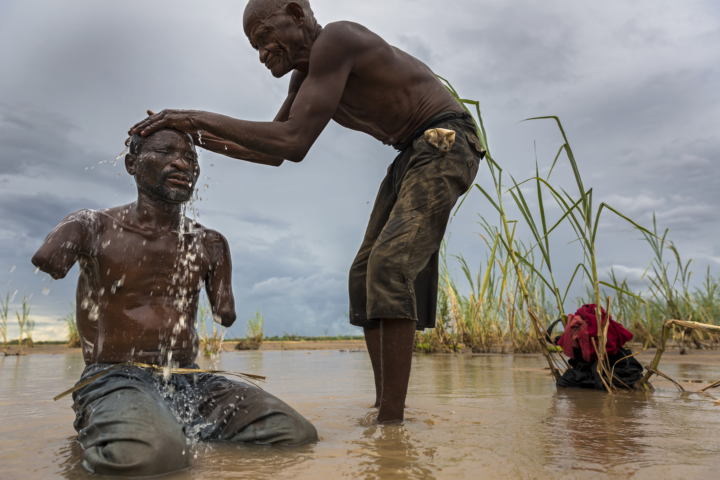RIFIJI, SELOUS, TANZANIA, 4 MARCH 2013: Yusuf Shabani Difika, 41, lost both his arms to a lion attack on a fishing trip on the border of Selous National Park, Tanzania. The lion attacked Yusuf and his arms were shredded beyond recovery as he attempt