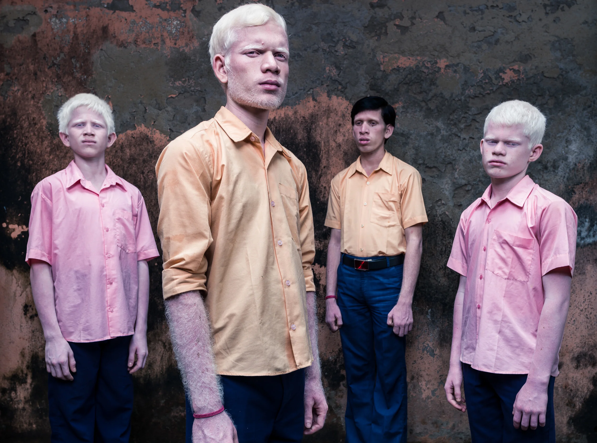 Blind Albino Boys - Vivekananda Mission School for the Blind - India, West Bengal, September 19, 2014.