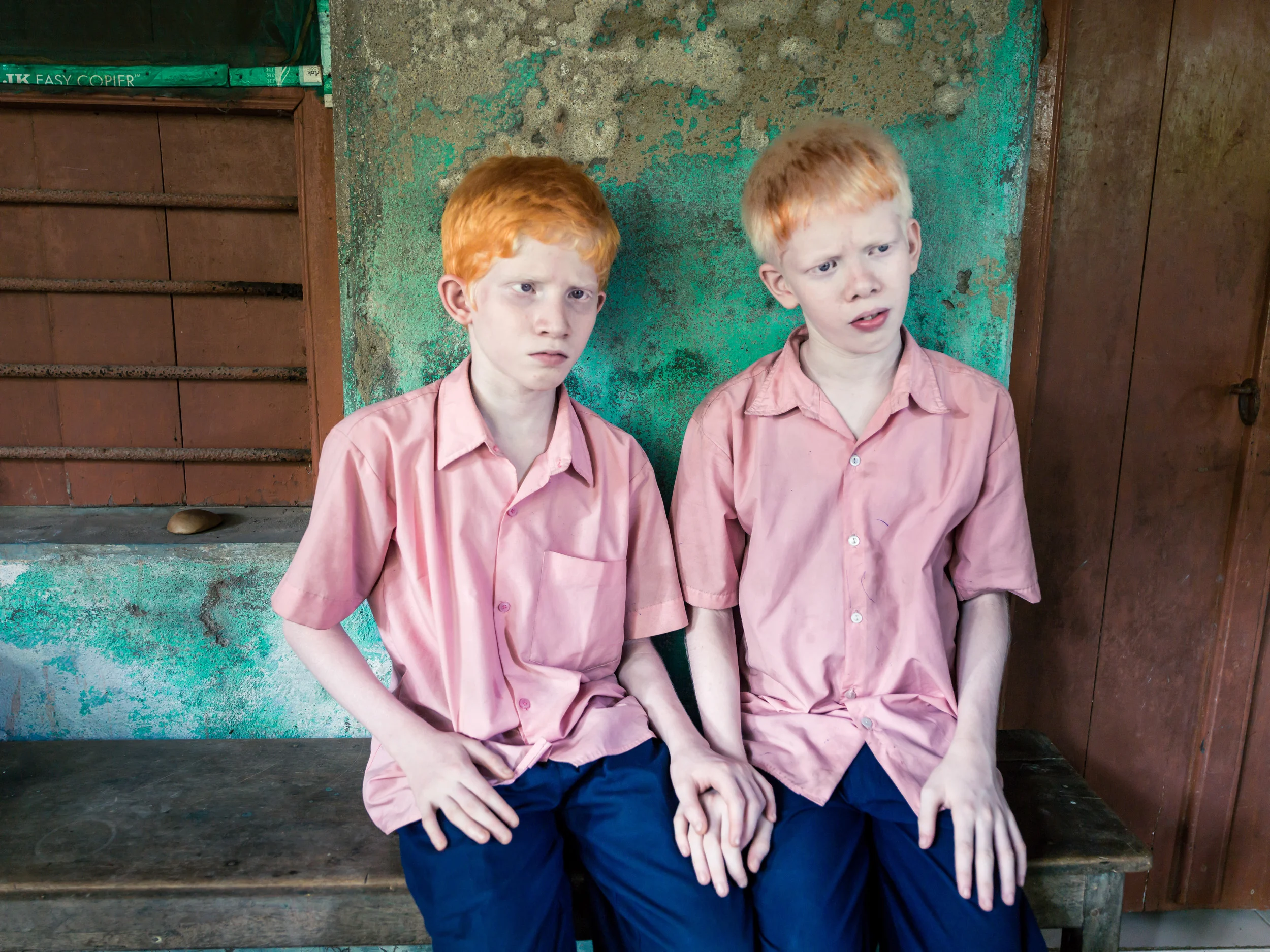 Blind Albino Boys - Vivekananda Mission School for the Blind - India, West Bengal, September 19, 2014.
