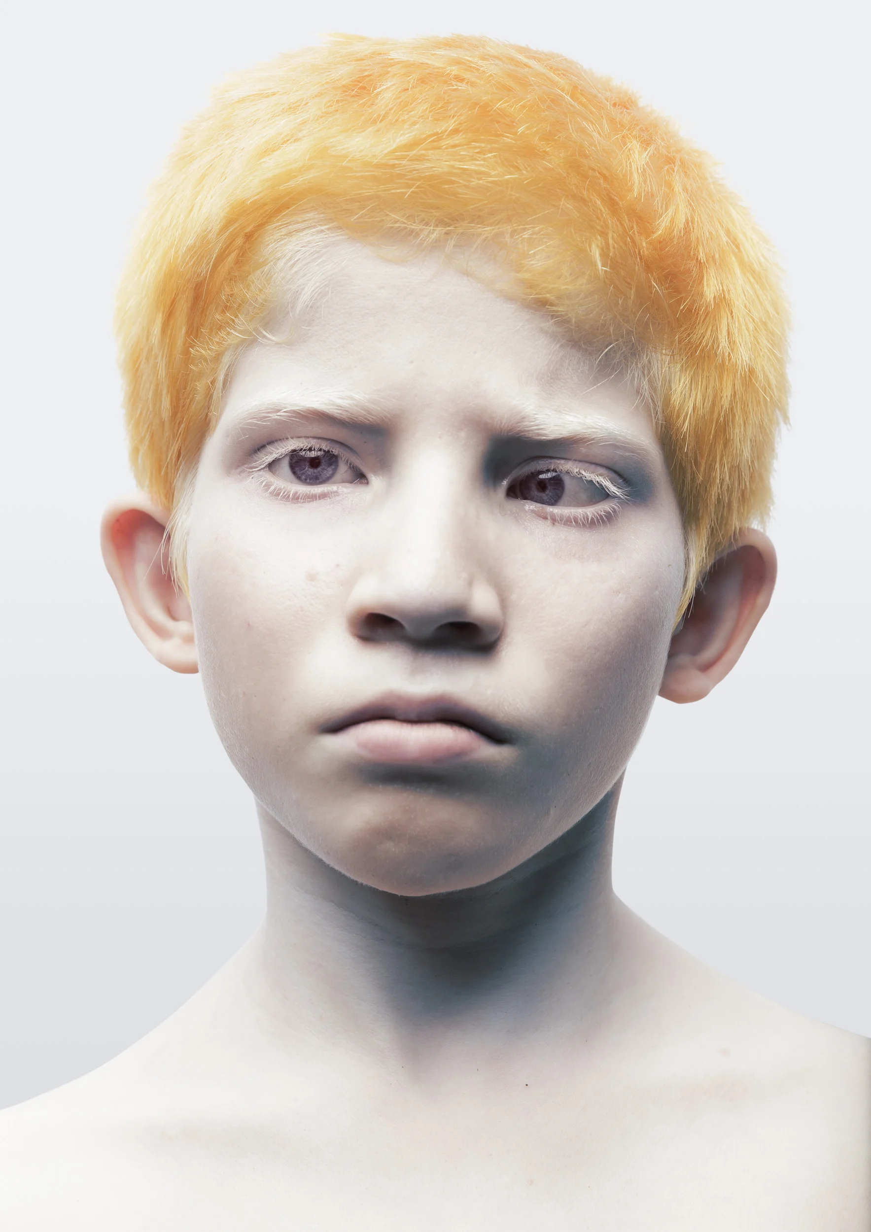 BlindAlbinism_12.jpg
