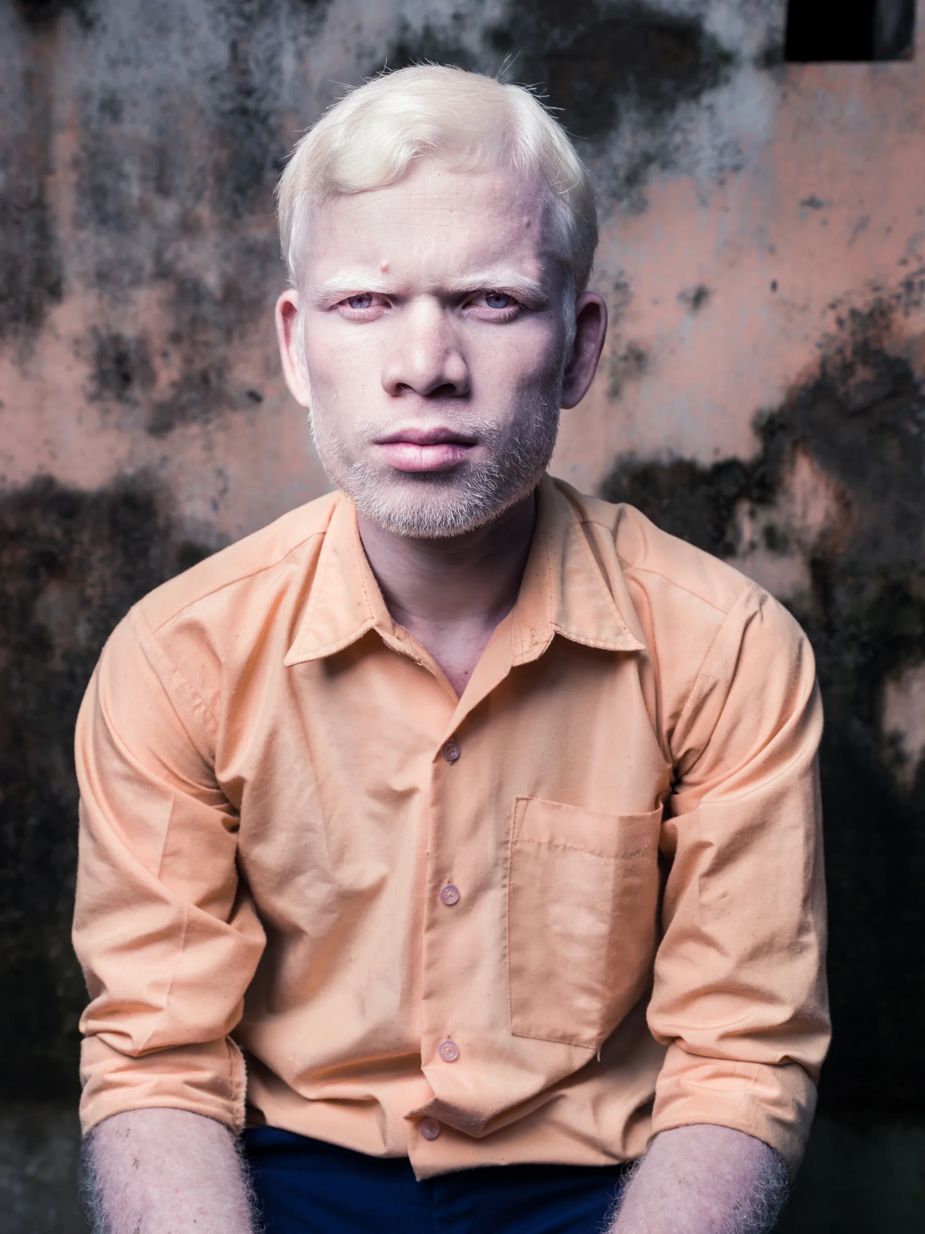 Blind Albino Boys - Vivekananda Mission School for the Blind - India, West Bengal, September 19, 2014.