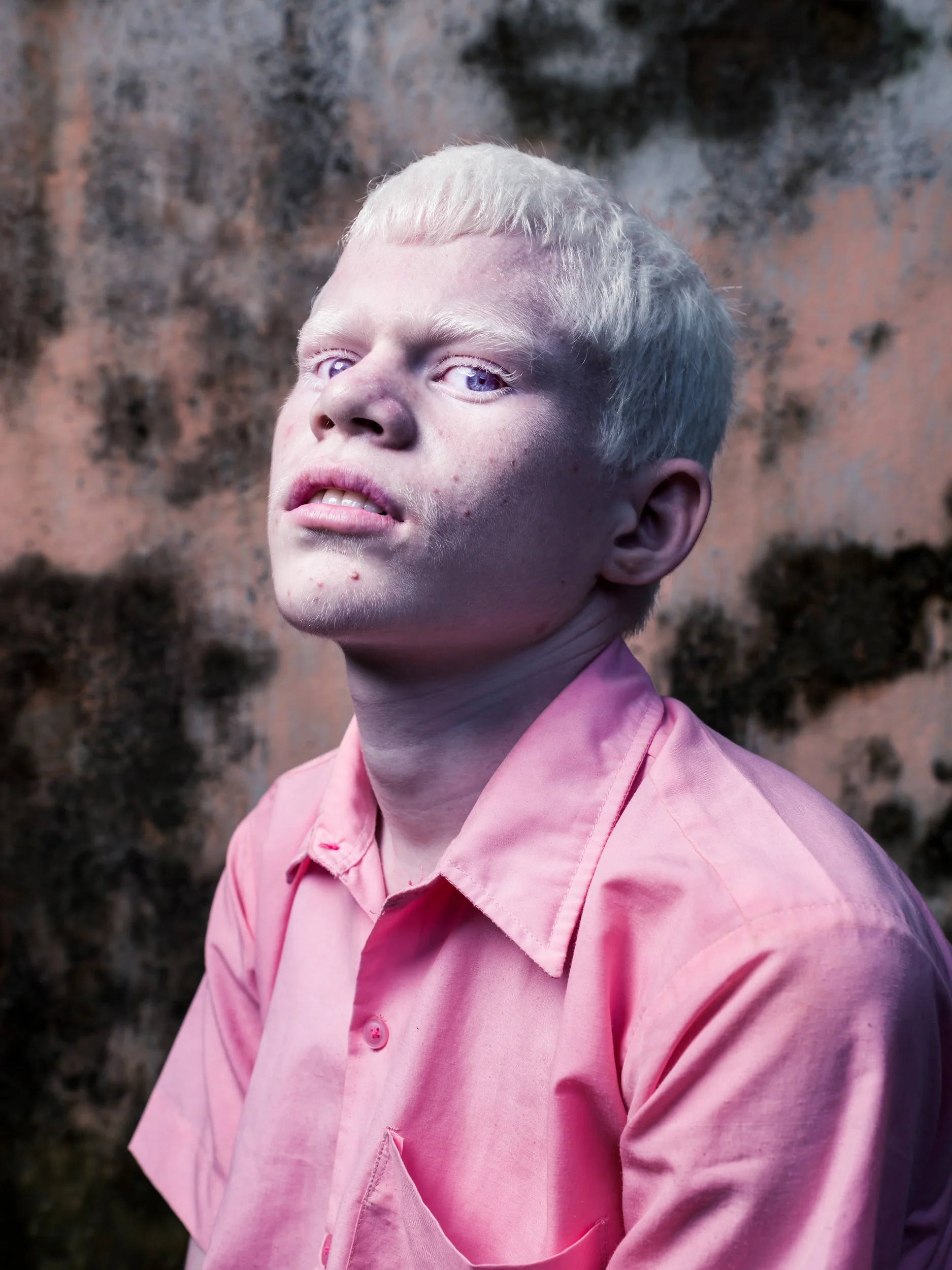 Blind Albino Boys - Vivekananda Mission School for the Blind - India, West Bengal, September 19, 2014.
