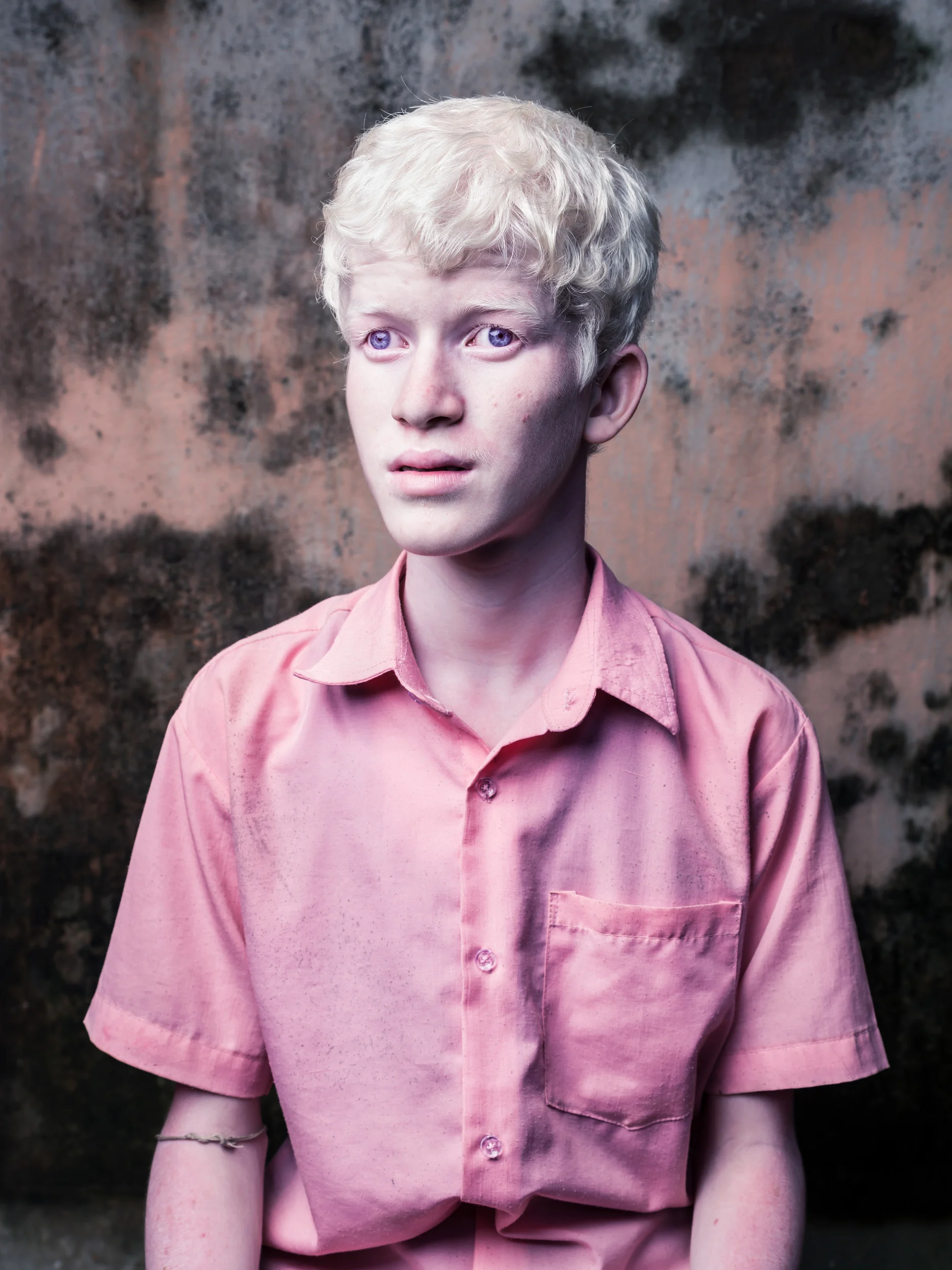 Blind Albino Boys - Vivekananda Mission School for the Blind - India, West Bengal, September 19, 2014.