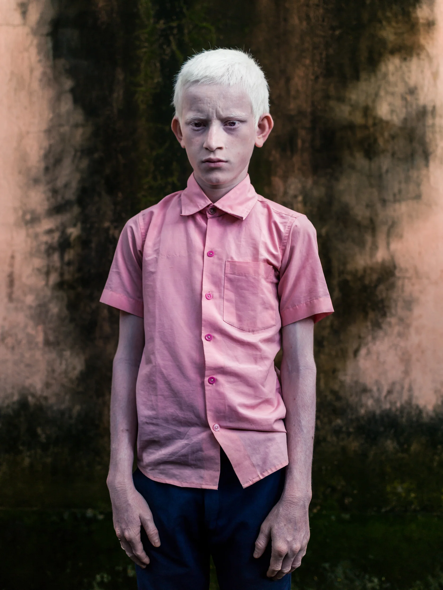 Blind Albino Boys - Vivekananda Mission School for the Blind - India, West Bengal, September 19, 2014.