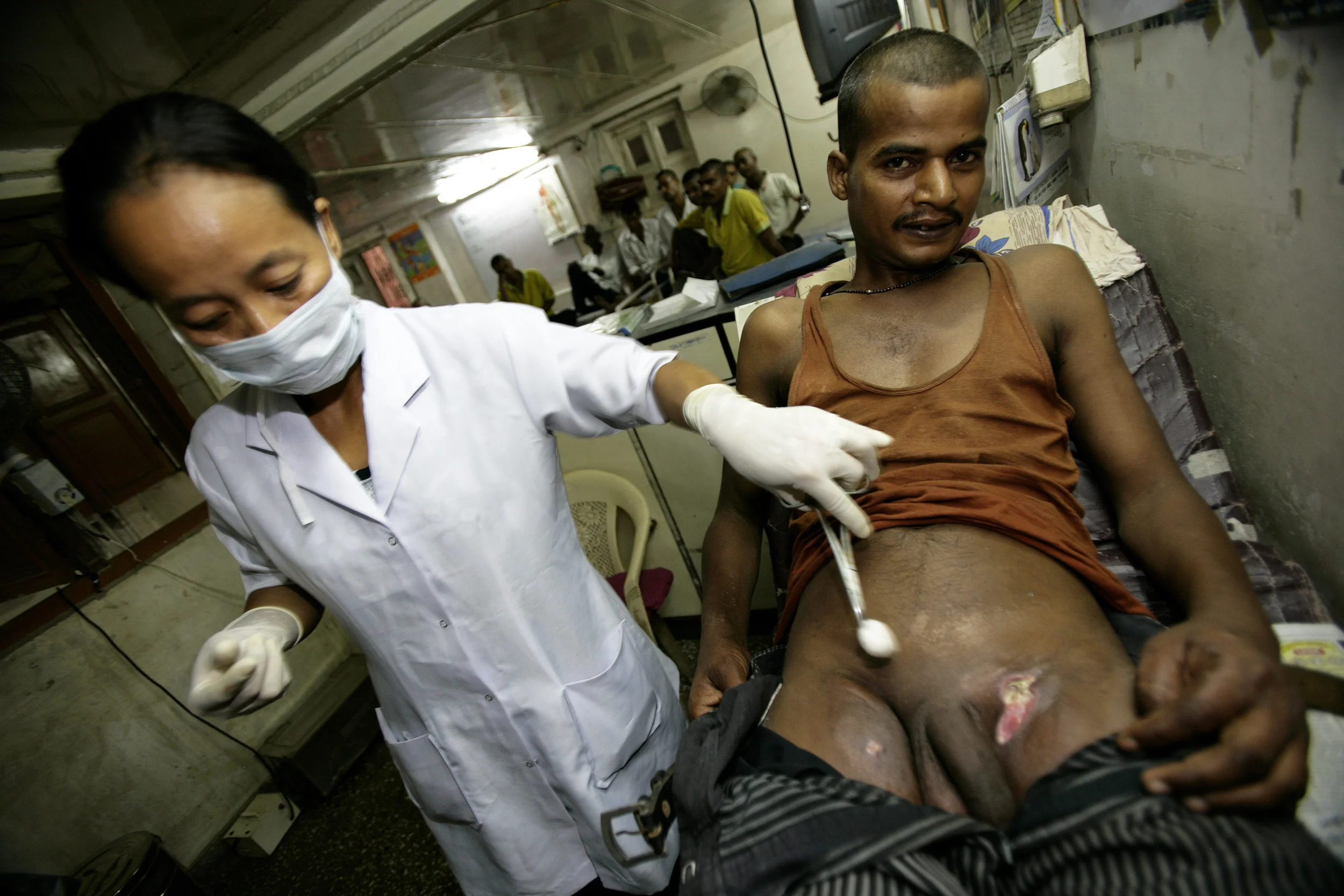 Delhi, India, June 2006: Sahara, a local NGO, provides a clinic for IV Drug users which functions to speed their rehab and to take care of their infections.