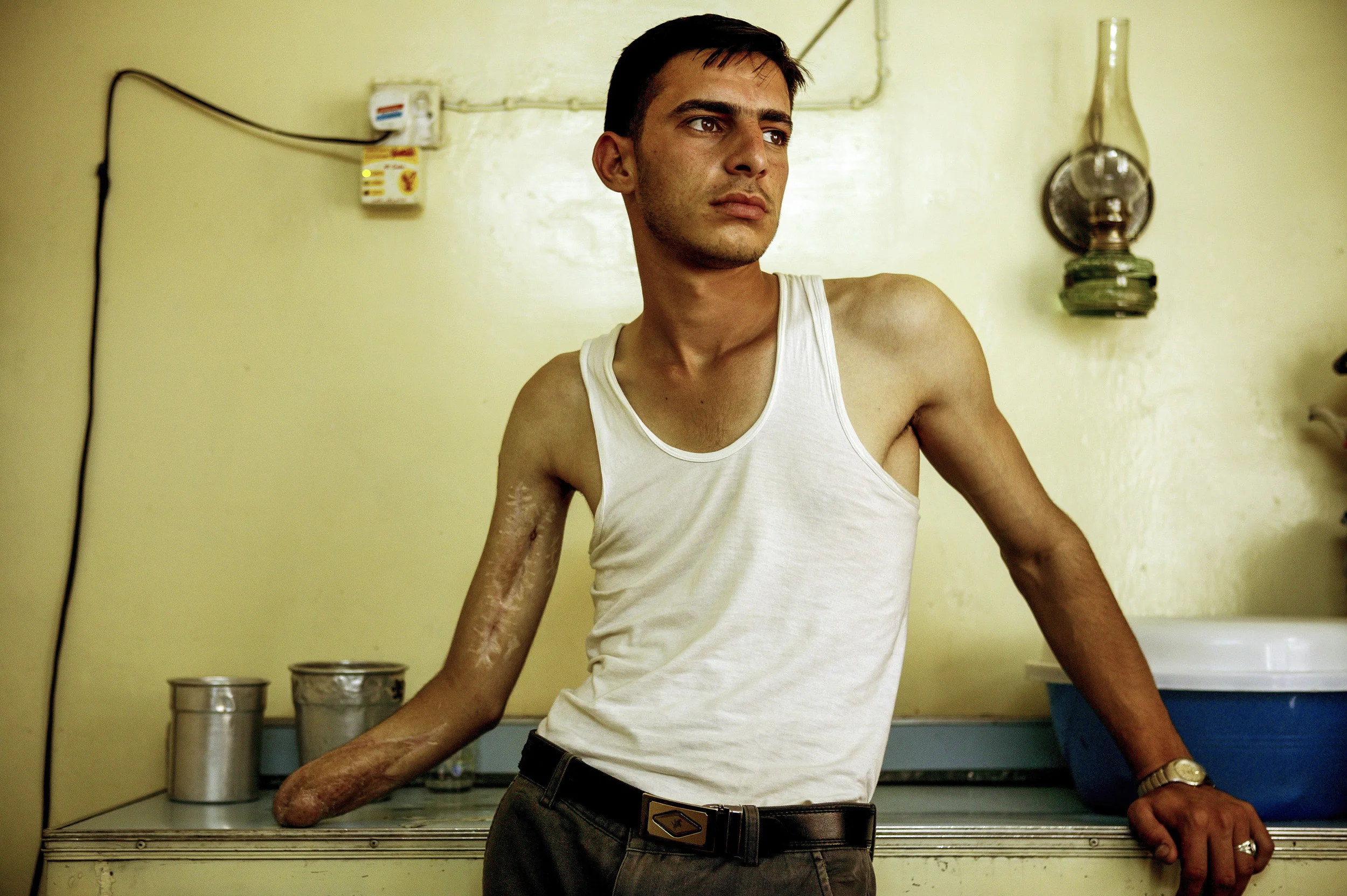 BAGHDAD,IRAQ - JUNE 06 : Ahmad Abd Al-Latif, 20, at his home in Baghdad. Ahmad lost his hand and the use of his arm when his brother and himself were caught in a cross-fire between coalition forces and resistance in Baghdad at the time the coalition took control of the capital. His brother was killed and he was forced to hide for the night in a toilet at a gas station. In the morning he was able to get to a hospital but doctors could not save his hand. Ahmad now suffers from depression and is ashamed of his condition. He is one of hundreds in this position in Baghdad. (Photo by Brent Stirton/Getty Images) *** Local Caption *** Iraq Assignment