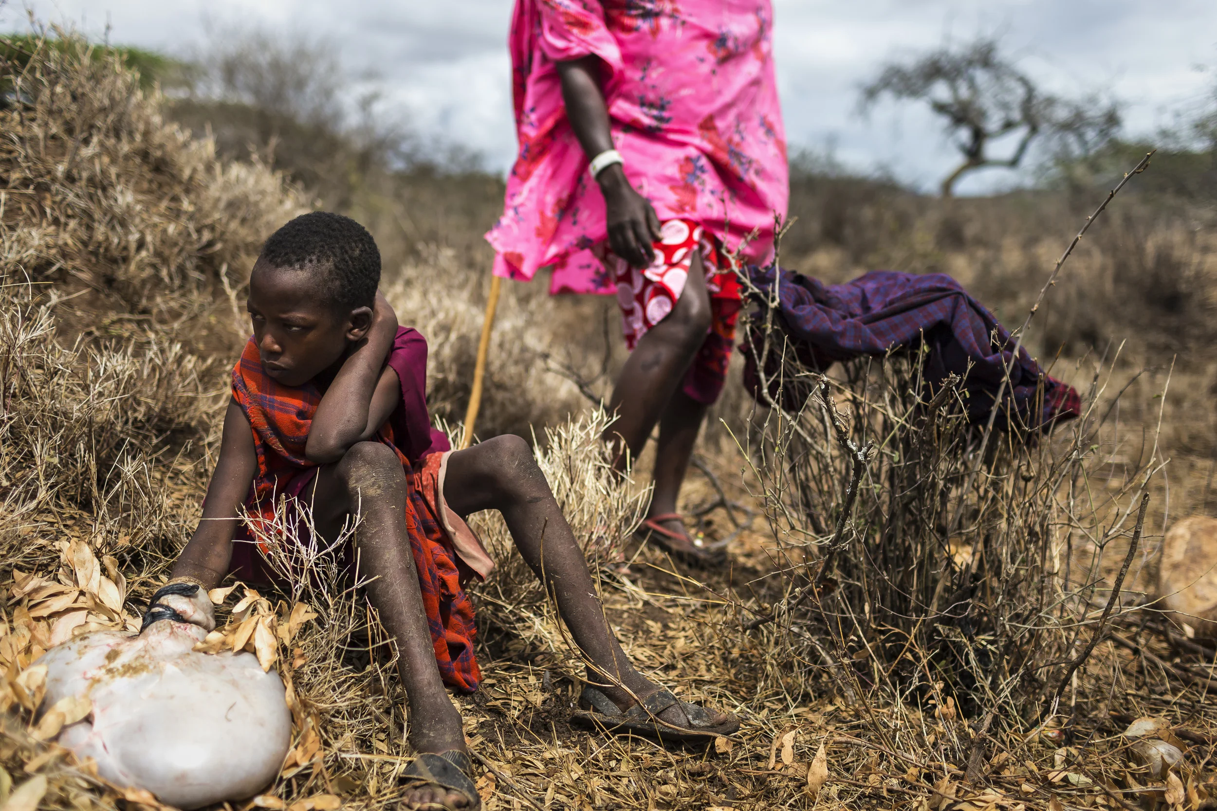 A young Masai boy heals a burnt hand inside a recently killed goat stomach, a traditional cure amongst Masai.