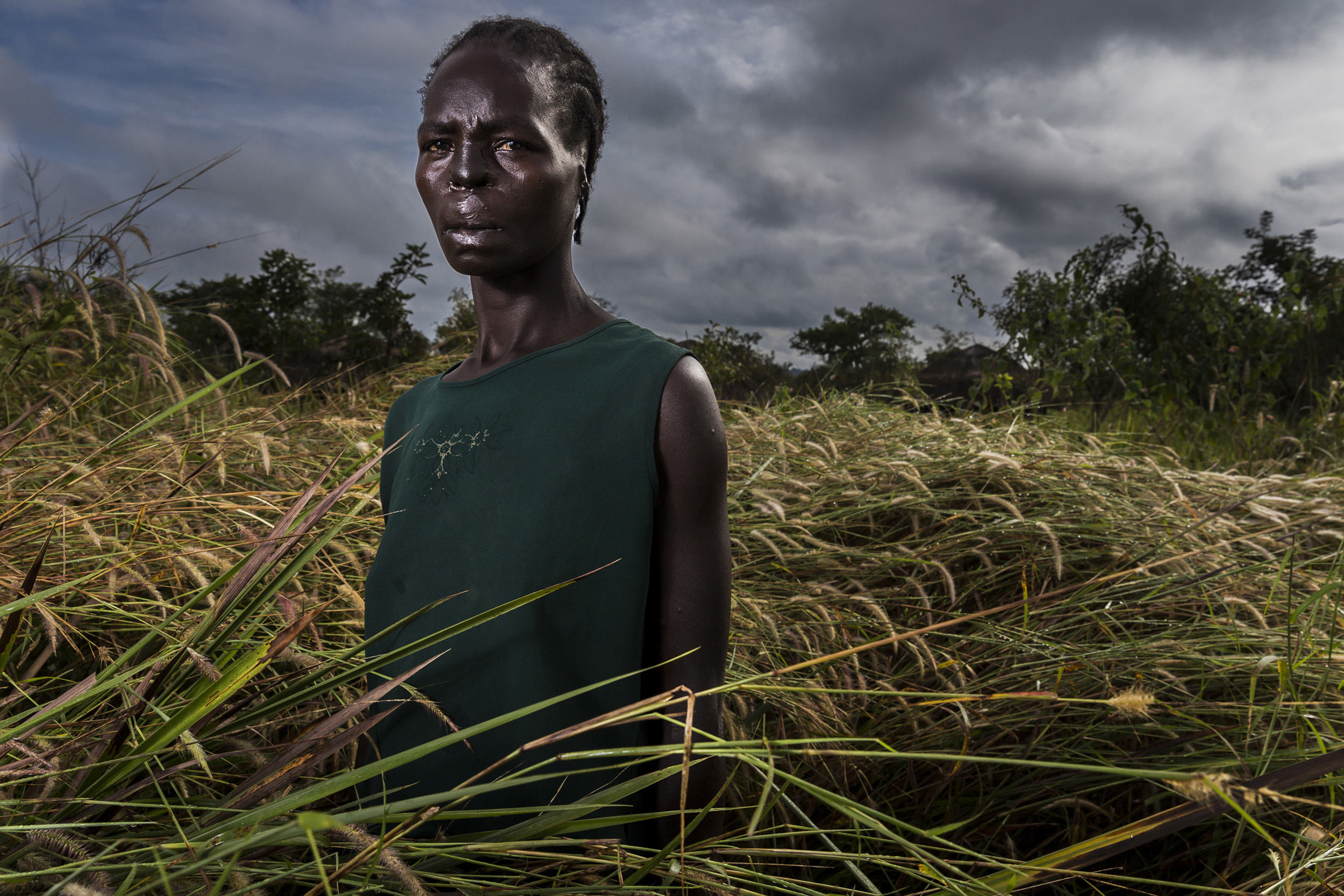 GULU, UGANDA, 21 NOVEMBER 2014: Margret Acino, 32, was attacked by members of the Lord’s Resistance Army when she was 23 and 9 months pregnant. Her lips, ears and nose were cut off and her breasts were hacked by a group of LRA men. Margret and a sma